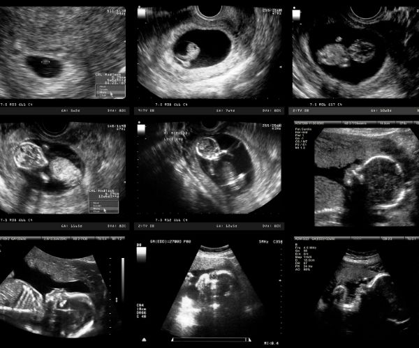 ultrasonido-obstetrico-y-de-alta-especialidad-en-interlomas